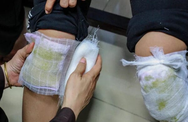 Bó thuốc